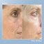3 Steps to Plumper Skin