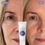 Pure Skin Face Wash before and after results.