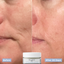 Tripeptide Before and After results