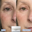 Tripeptide Before and After results