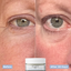 Tripeptide Before and After results