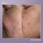 Azelaic Dark Spot Serum 30ml