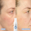 Before and after of collagen boost face moisturiser with hyaluronic acid, showing brighter skin and improved texture after 30 days