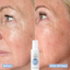 Before and after of collagen boost peptide moisturiser with hyaluronic acid, showing plumper skin and reduced wrinkles after 30 days